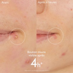 CAUDALIE VINOPURE STOP BOUTONS SALICYLIQUE 15ML