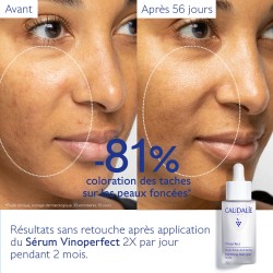 CAUDALIE VINOPERFECT SERUM ECLAT ANTI-TACHES 30ML