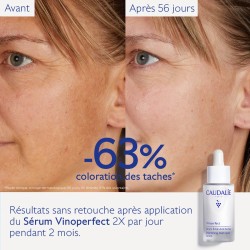 CAUDALIE VINOPERFECT SERUM ECLAT ANTI-TACHES 30ML